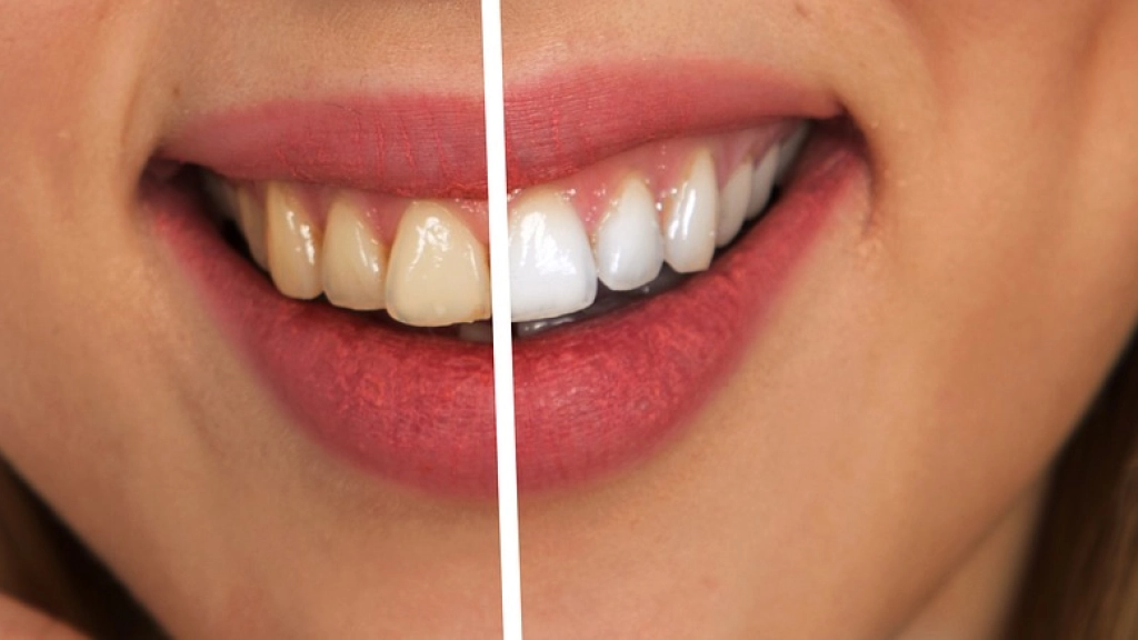 diente, cuidado dental, blanco, Pixabay