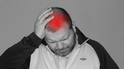 Migraña: El vínculo alarmante con la depresión y la ansiedad en personas con sobrepeso, revelan expertos en neurología