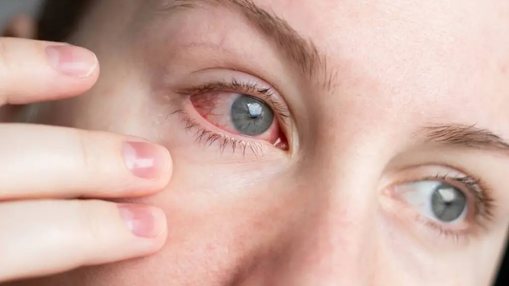 Alergia irritación en los ojos, Prensa