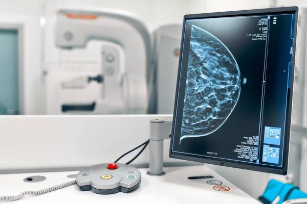 Mamografía a tiempo: la clave frente al cáncer de mama que amenaza a una de cada ocho mujeres en Chile